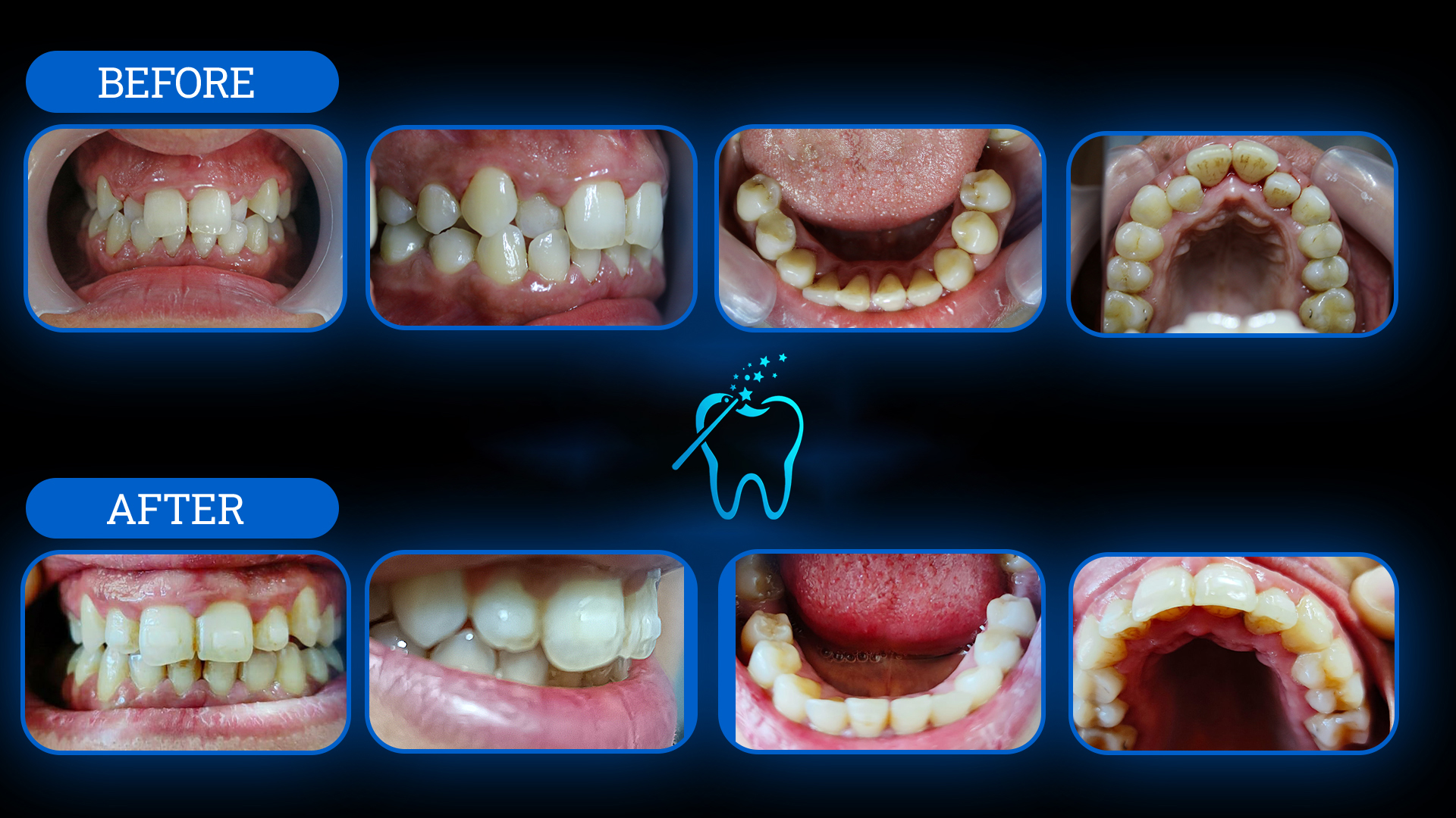 Tedavi Öncesi ve Sonrası 1