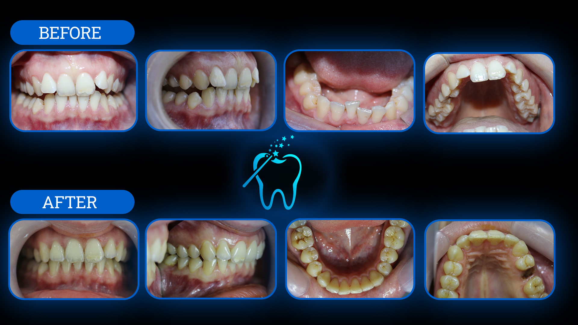 Tedavi Öncesi ve Sonrası 2