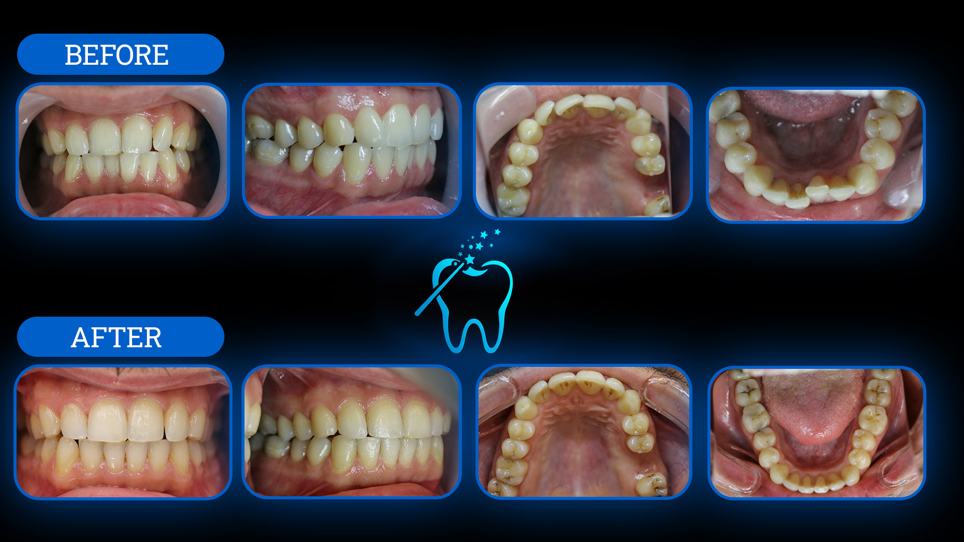 Tedavi Öncesi ve Sonrası 3