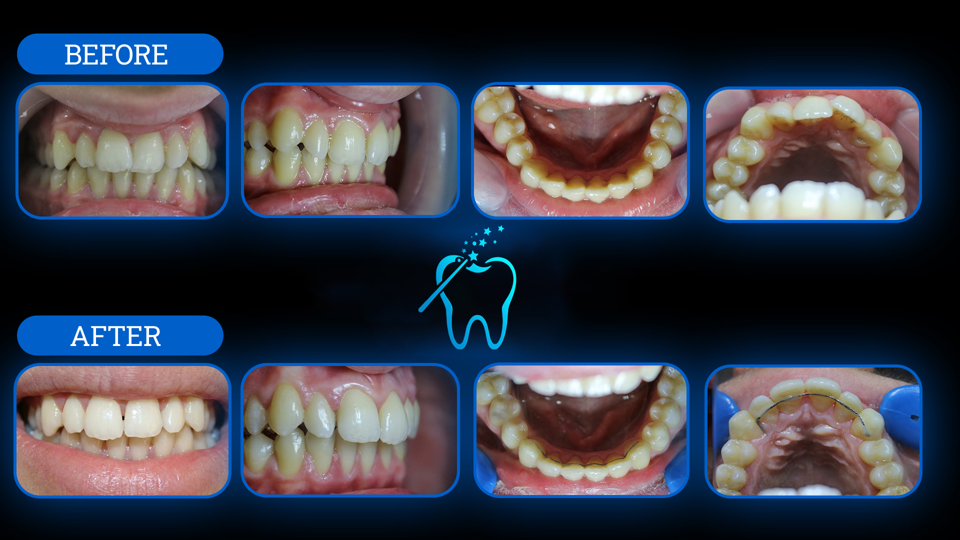 Tedavi Öncesi ve Sonrası 4