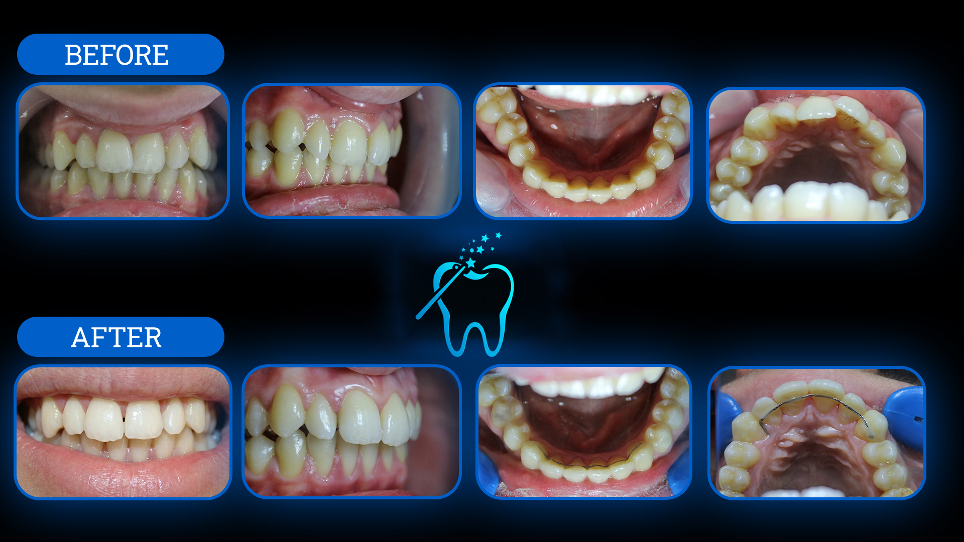 Tedavi Öncesi ve Sonrası 5