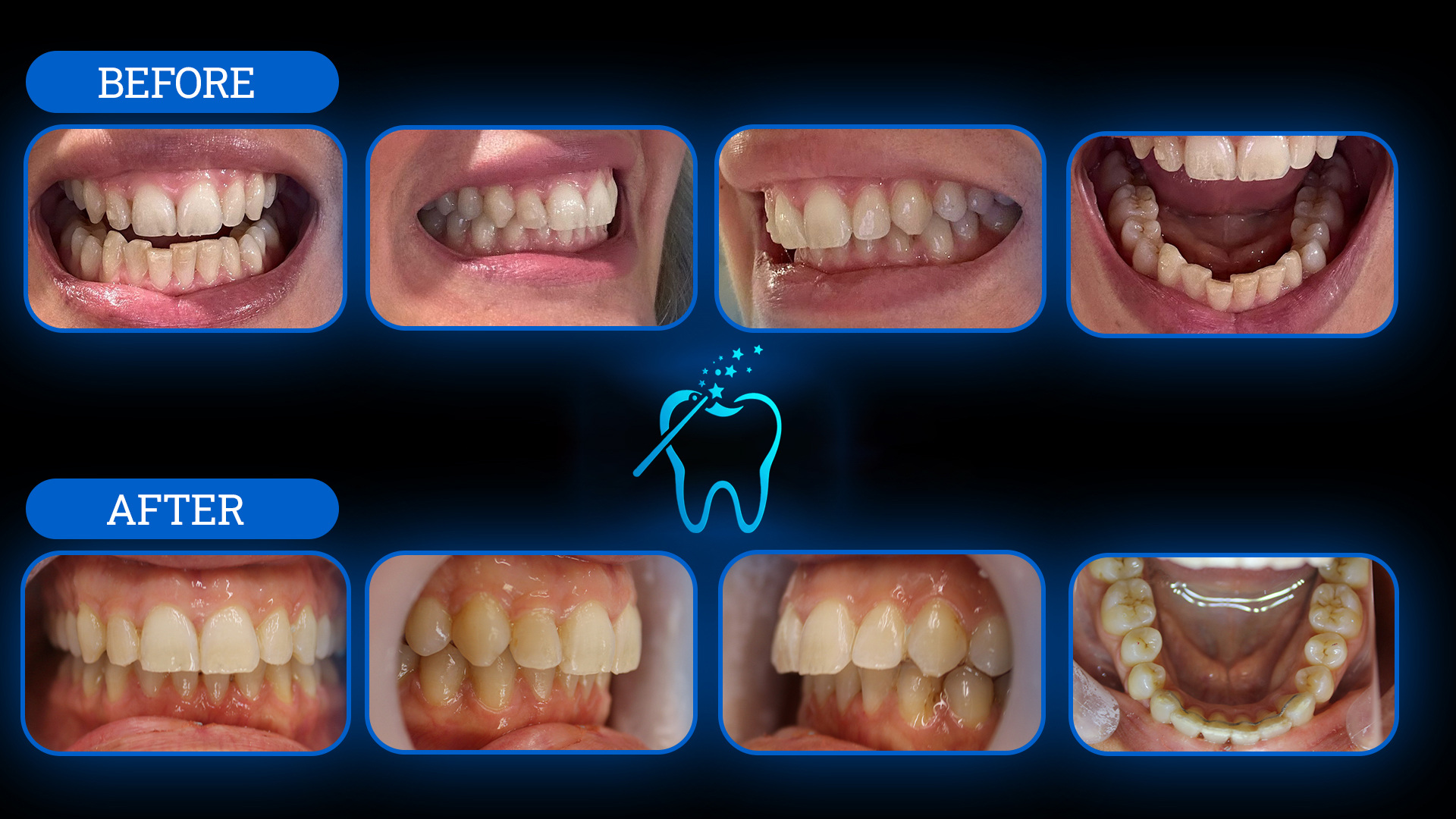 Tedavi Öncesi ve Sonrası 6